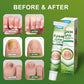Sumifun Gel -damaged nail treatment, nail restoration Gel