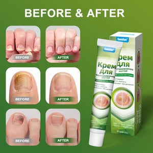 Sumifun Gel -damaged nail treatment, nail restoration Gel